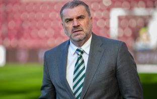 Celtic Legend on Ange Postecoglou’s Priorities