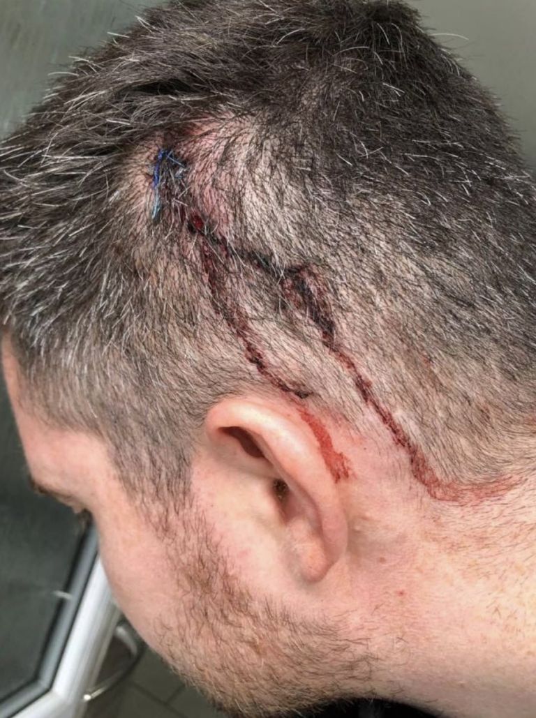 Celtic physio Daniel Friel